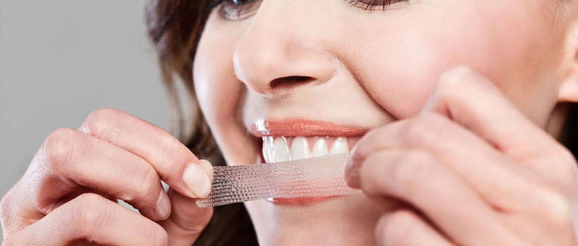 Direct Teeth Whitening